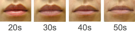 увеличение губ, коррекция губ